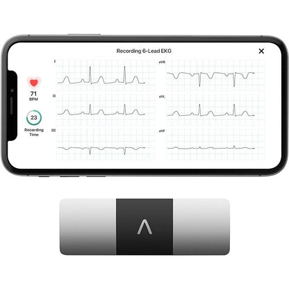 Kardia Mobile 6-Lead Personal EKG Monitor–Six Views of The Heart–Detects AFib and Irregular Arrhythm